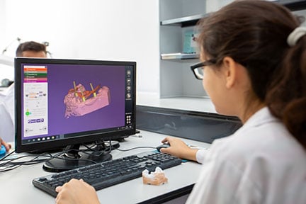 CAD-CAM