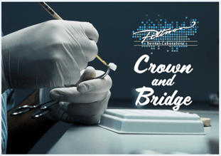Crown & Bridge Picture