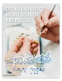 Crown-and-Bridge-Brochure_Cover