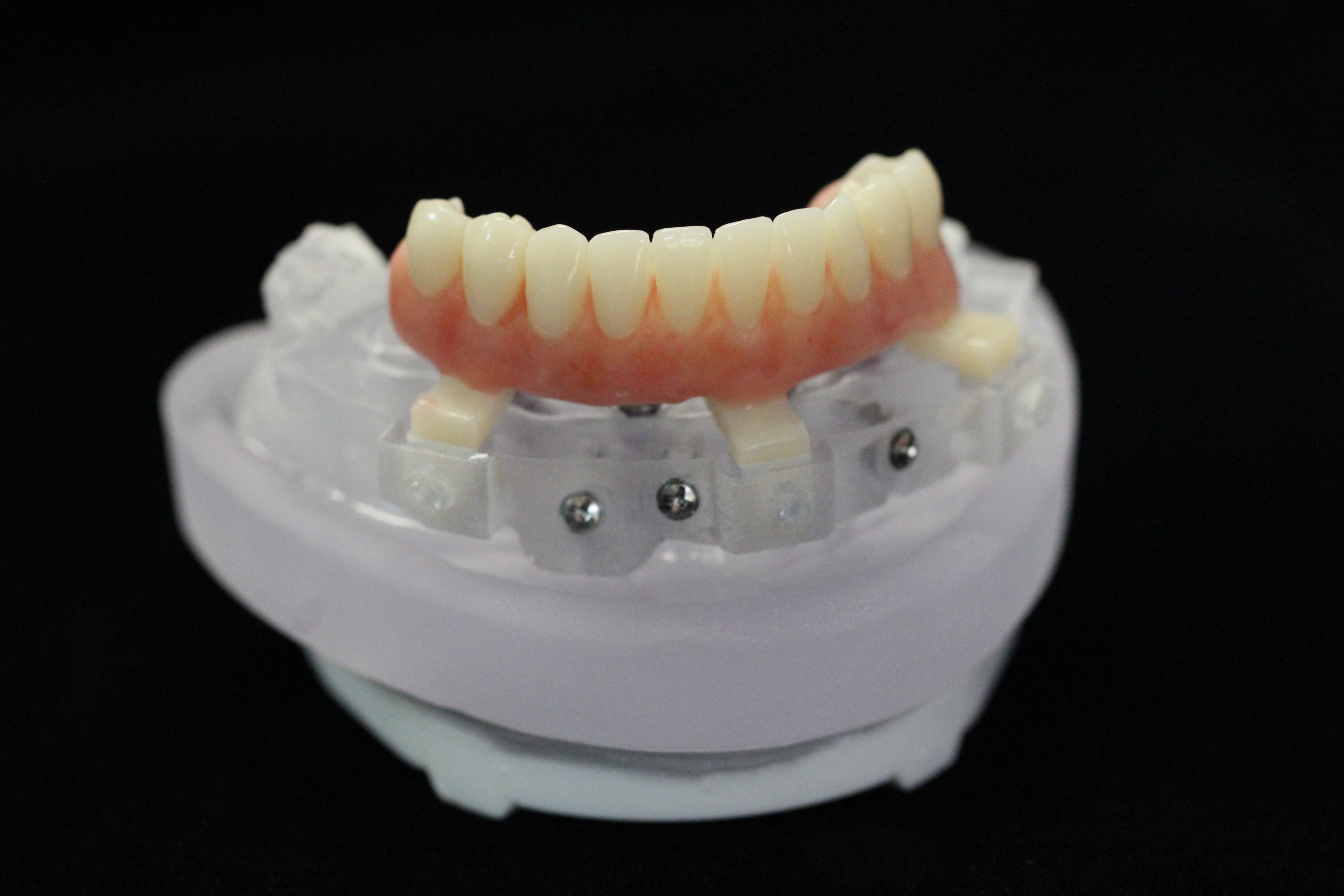 Surgical Guides Pittman Dental Laboratory