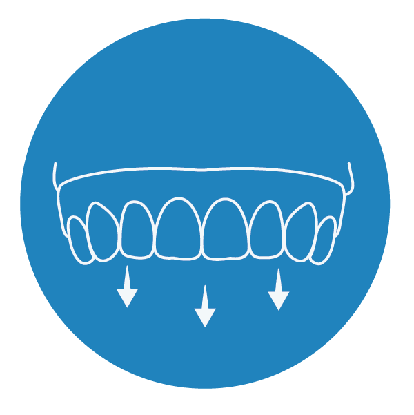 Denture and Partials