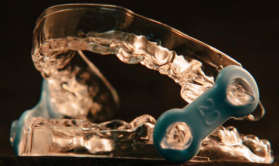 Elastic Mandibular Advancement Appliance