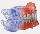 Pittman Digital Dentures