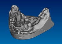 Send a STL File - Pittman Dental Laboratory