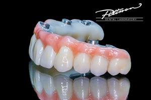 Same-day-implant