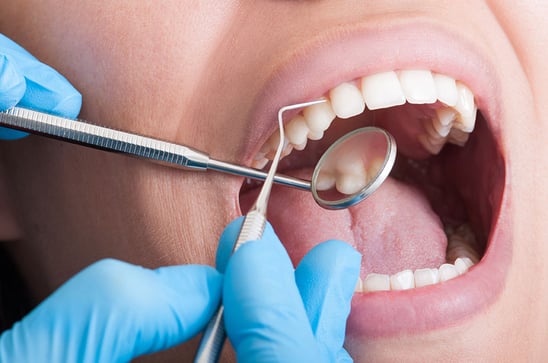 Tooth-examination