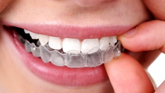 Your-Smile-Factor-Invisible-Aligner